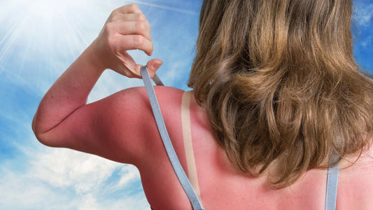 What Happens When Your Skin Gets Sunburned, And How to Best Protect It
