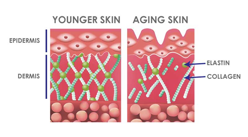 A graphic illustrating younger vs aging skin with the epidermis, dermis, elastin, and collagen.