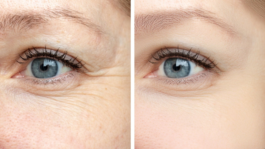 Before and after image of a woman's eye, showing the effects of Vitali's eye cream.