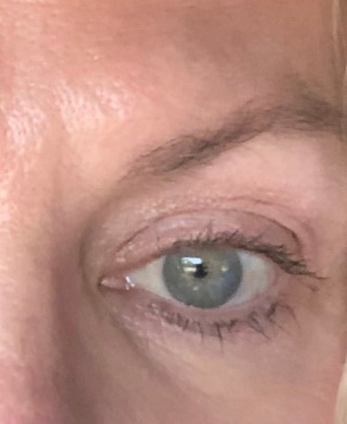 Close-up of an eye with smooth skin, highlighting anti-aging skincare results.