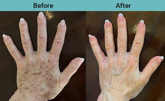 What do your hands say about your age? - Vitali Skincare